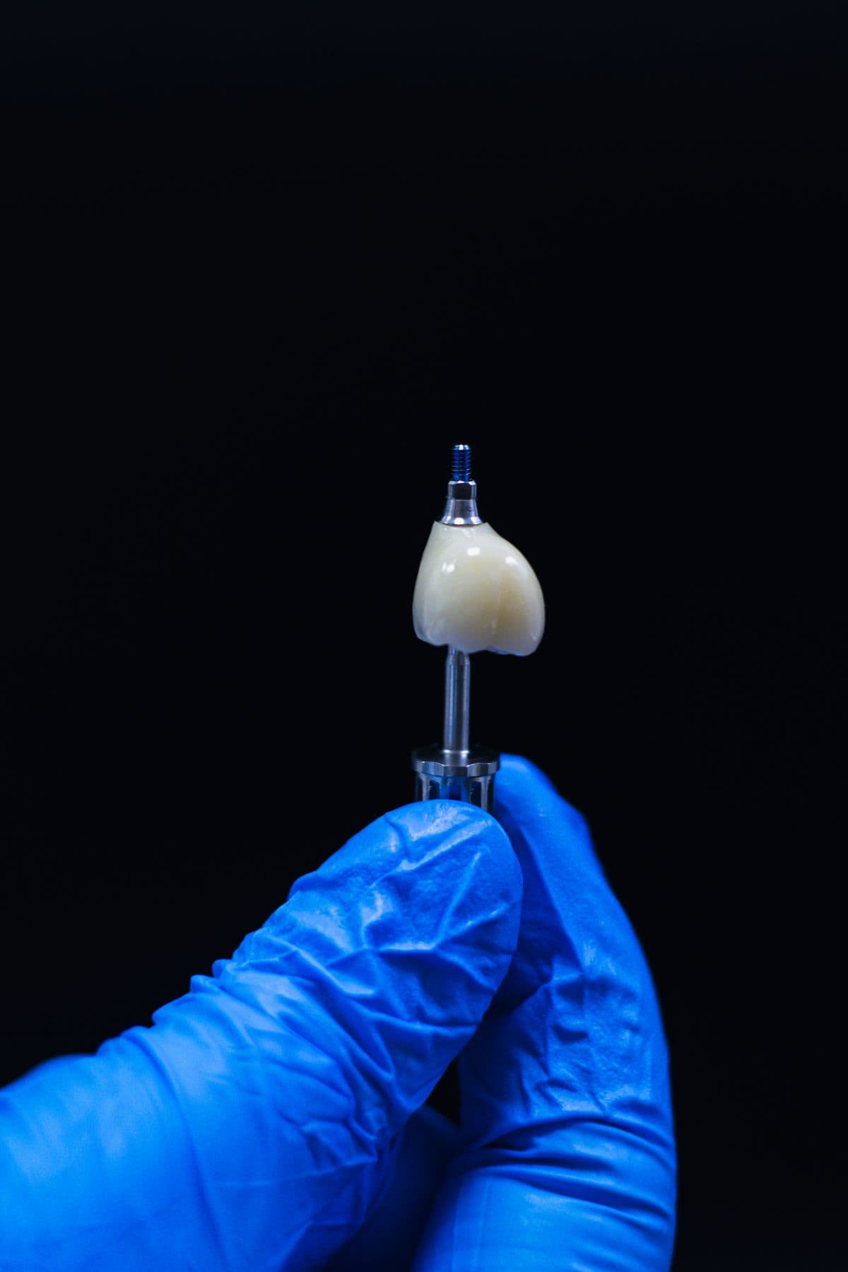 A dental implant crown and abutment held in a gloved hand